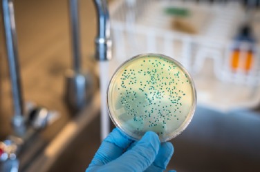 Control de Plagas en Zaragoza • MaxB Desinfecciones • Cultivo Bacterias del Agua